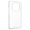 Fixed Story | Back Cover | Xiaomi | Redmi Note 14 Pro 4G | TPU | Clear