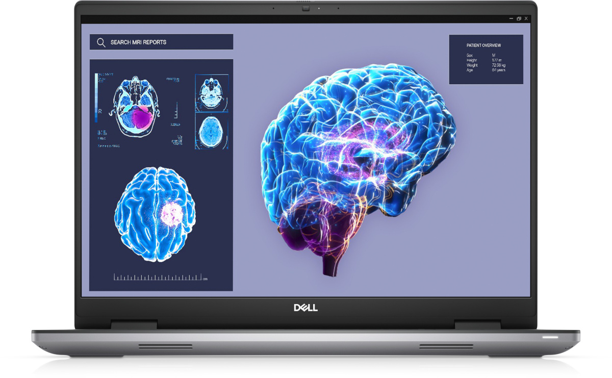 Dell sülearvuti Precision 7680-8JD10 (hall, Windows 11 Pro 64-Bit, 40.6 cm (16 Zoll) & 60 Hz Display, 1 TB SSD)