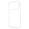 Fixed Story AntiUV | Back cover | Xiaomi | Redmi Note 15 4G | TPU | Transparent